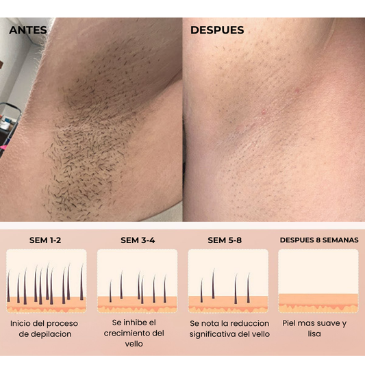 Depiladora IPL Luxmau™ | Piel Suave sin Vello en Semanas