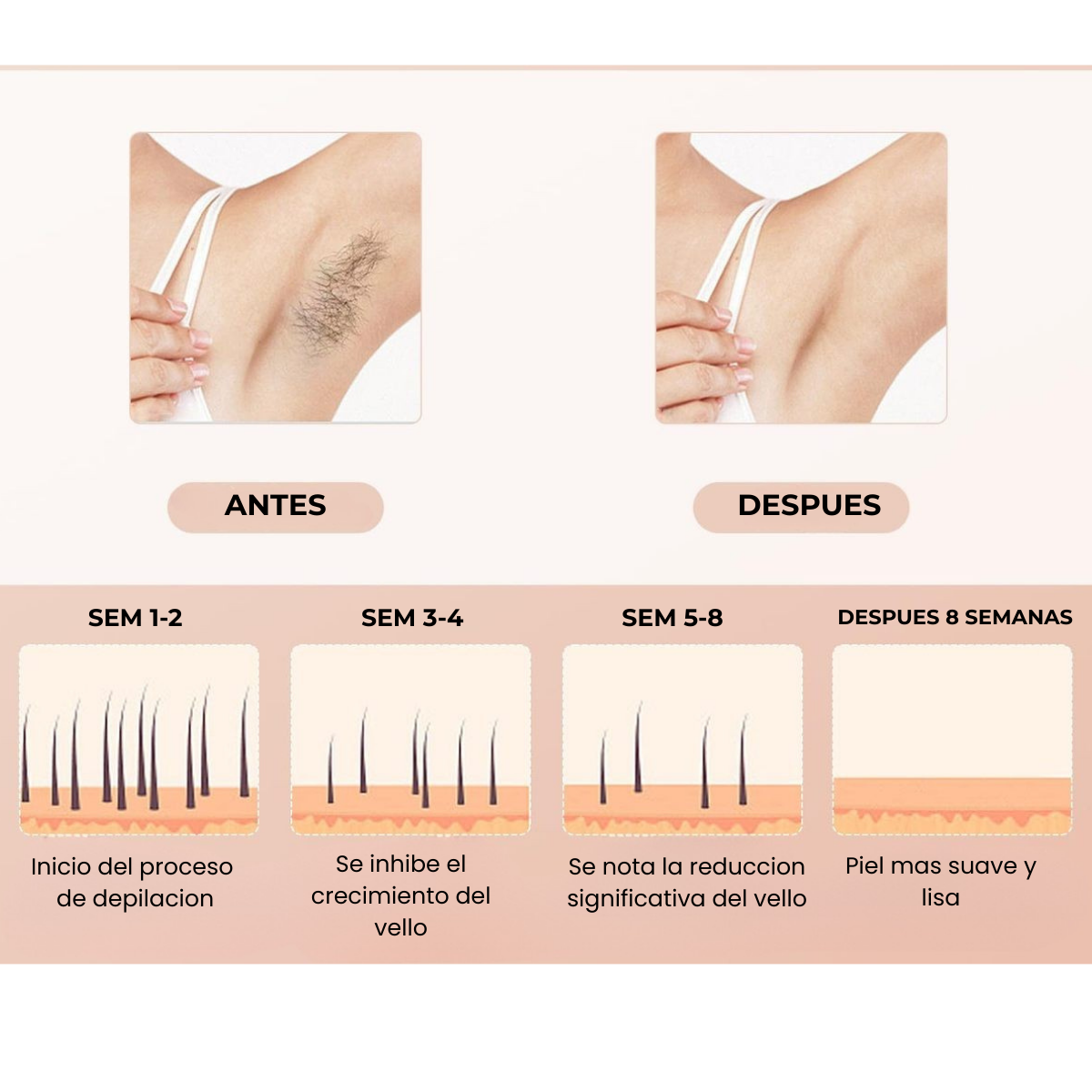 Depiladora IPL Laser Definitiva