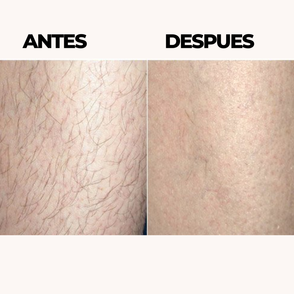 Imagen descriptiva