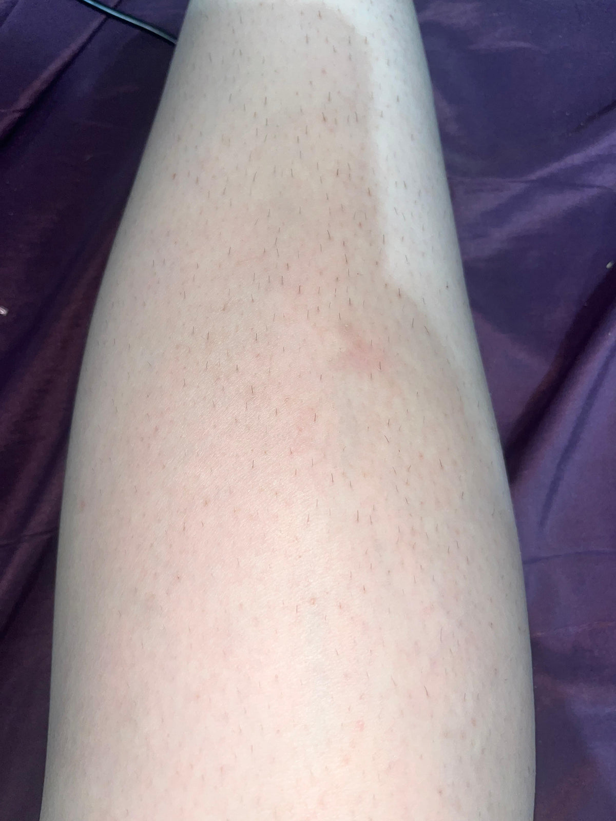 Imagen del testimonio